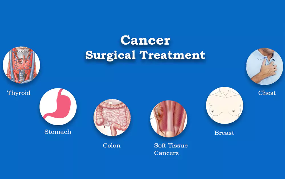 Cancer Treatment In pune